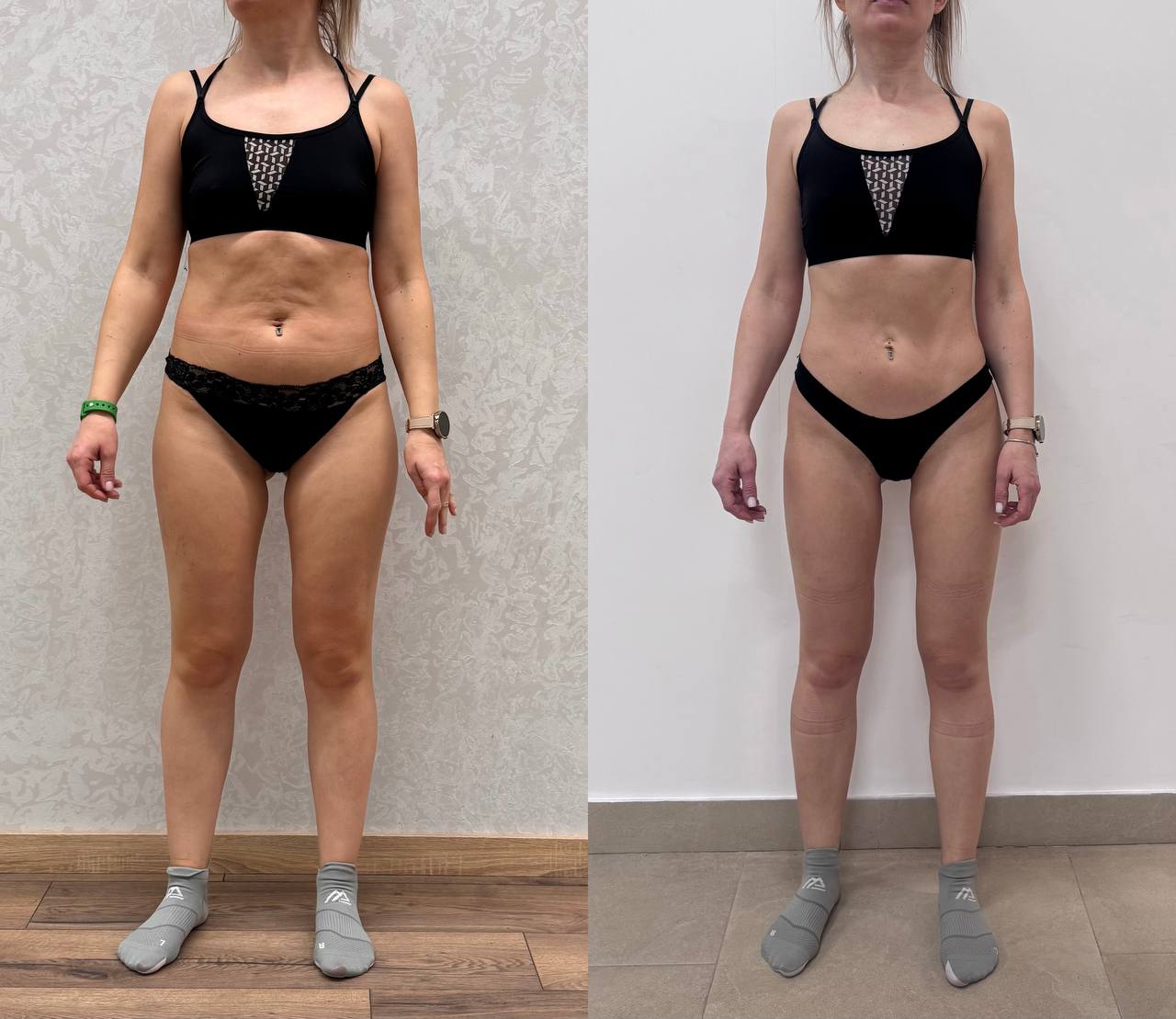 Девушка 9 результат